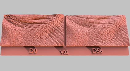 3D aquisitions - 3D impressions of under eye wrinkles -  Gatuline Link n Lift
