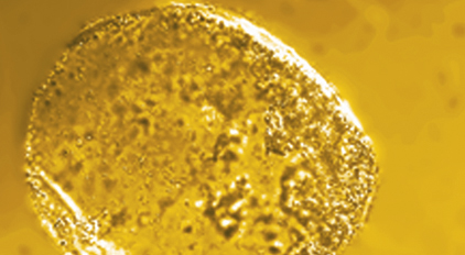 cells in suspensions - Fresh cells mango
