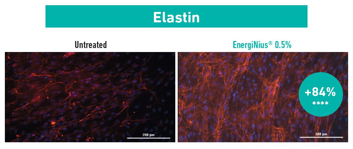 synthesis of elastin with EnergiNius