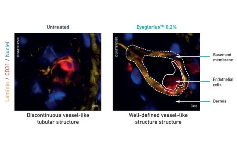 Vessel like structure with eyeglorius