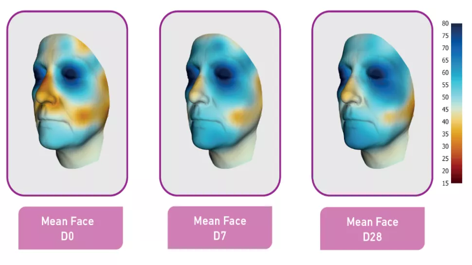 Mean Face Emulium Dolcea MB