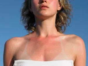 aftersun